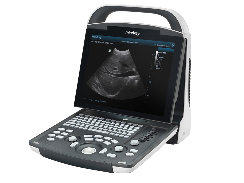 NOUVEAU ÉCHOGRAPHE MINDRAY DP-20