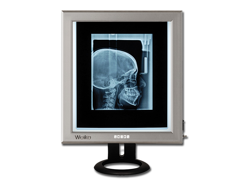 NÉGATOSCOPE DE BUREAU ULTRA-FIN LED 42x36 cm