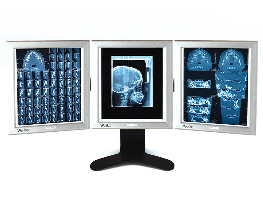 NÉGATOSCOPE DE BUREAU ULTRA-FIN LED 42x36 cm - triple