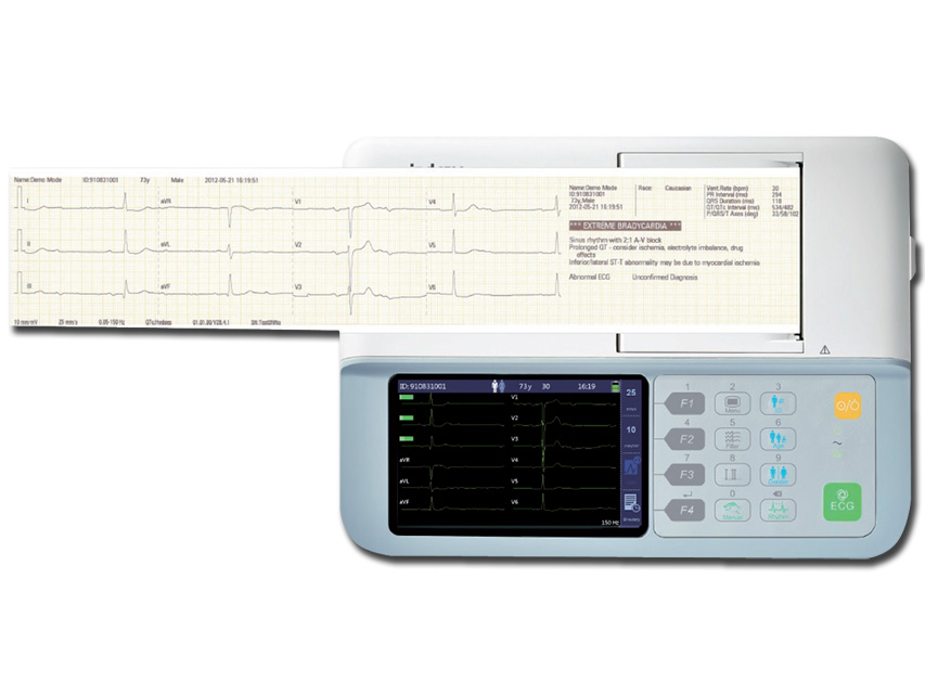ÉLECTROCARDIOGRAPHE BENEHEART R3 MINDRAY