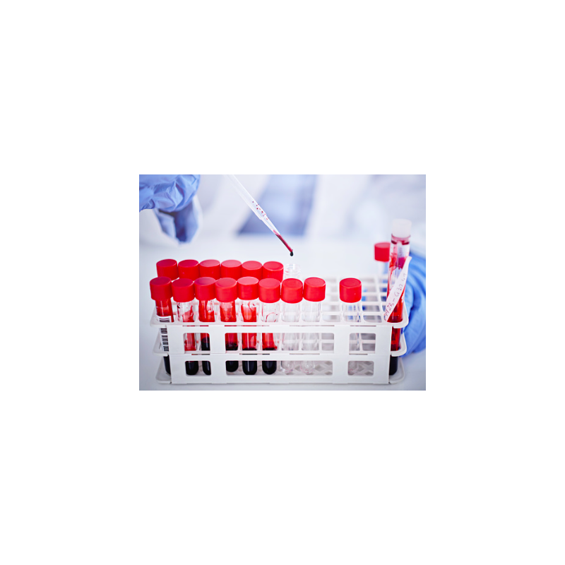 Boîte de 200 filtres pour cytologie