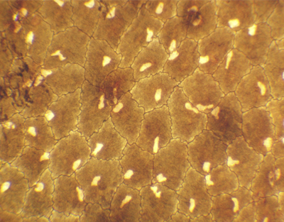 Épithélium simple squameux, s.e.