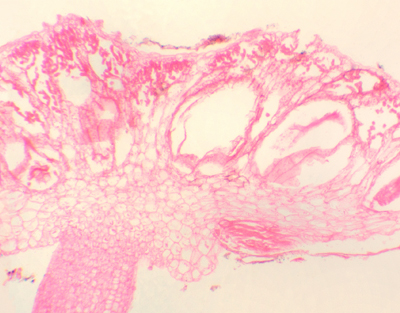 Anthéridie de Marchantia, c.l.