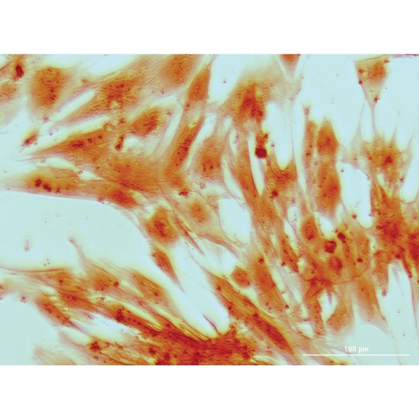 EZstain™ Osteocyte Staining Kit