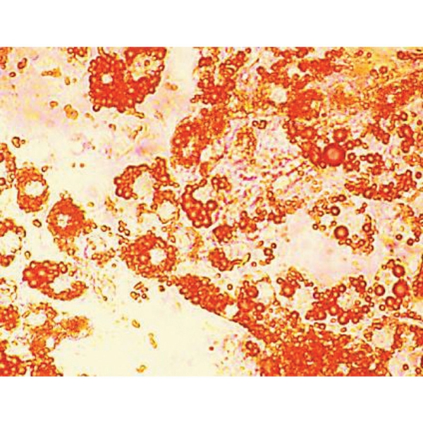 HiDiff™ Adipogenesis Assay Kit 