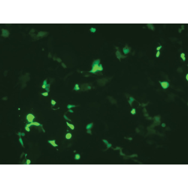 HiTransfect™ Transfection Medium, Serum Free, Animal Component Free, Low protein with Sodium bicarbonate without L-Glutamine Part A - Basal Medium  Part B - Low Protein Growth Supplement 