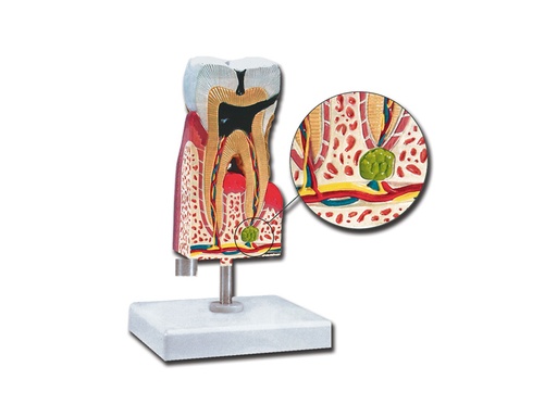 [40214] MÂCHOIRE INFÉRIEURE AVEC CARIES - 10X