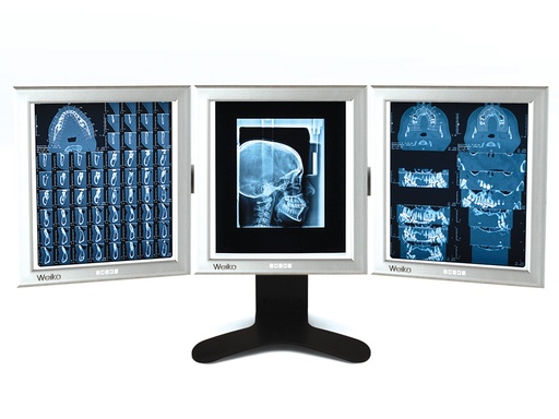 [44707] NÉGATOSCOPE DE BUREAU ULTRA-FIN LED 42x36 cm - triple