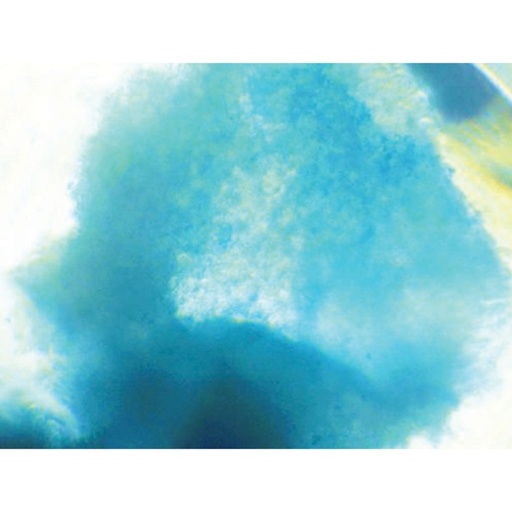[CCK029-1KT] EZstain™ Chondrocyte Staining Kit