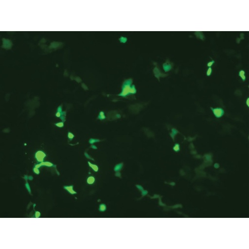 [SFM015-500ML] HiTransfect™ Transfection Medium, Serum Free, Animal Component Free, Low protein with Sodium bicarbonate without L-Glutamine Part A - Basal Medium  Part B - Low Protein Growth Supplement 